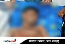 দ্বিতীয় স্ত্রীর বিরুদ্ধে যুবকের গোপনাঙ্গ কাটার অভিযোগ, হাসপাতালে নিলেন তৃতীয় স্ত্রী