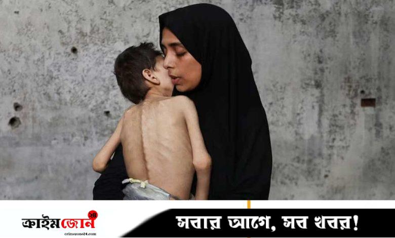‘গাজার মানুষ না মৃত না জীবিত, তারা আসলে হাঁটাচলা করা কঙ্কাল’