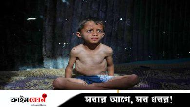 গাজায় অনাহারে মৃত্যু ১১৫, ইউরোপজুড়ে জোরালো হচ্ছে ইসরায়েলবিরোধী অবস্থান