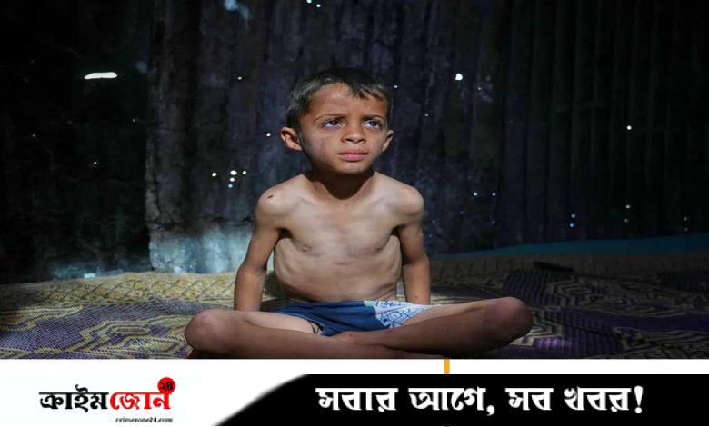 গাজায় অনাহারে মৃত্যু ১১৫, ইউরোপজুড়ে জোরালো হচ্ছে ইসরায়েলবিরোধী অবস্থান