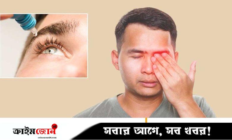 চোখ আগুনে ক্ষতিগ্রস্ত হলে কী করা জরুরি