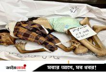 ইসরায়েলি অবরোধে গাজার ২৭ বছরের যুবকের মৃত্যু, অনাহারে ওজন নেমেছিল ১৫ কেজিতে