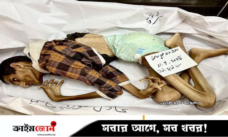 ইসরায়েলি অবরোধে গাজার ২৭ বছরের যুবকের মৃত্যু, অনাহারে ওজন নেমেছিল ১৫ কেজিতে