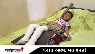 বাসে রেডিয়েটর বিস্ফোরণে দগ্ধ শিশুটি যন্ত্রণায় কাতরাচ্ছে