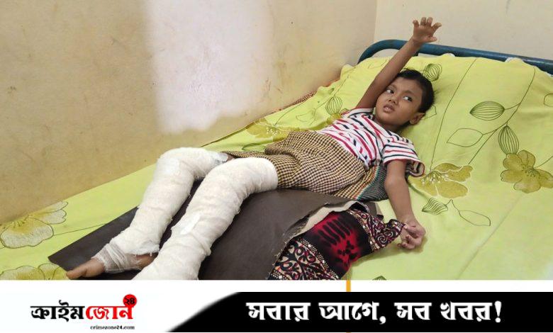 বাসে রেডিয়েটর বিস্ফোরণে দগ্ধ শিশুটি যন্ত্রণায় কাতরাচ্ছে