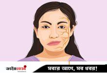 মুখ বেঁকে যাওয়া রোগের চিকিৎসা