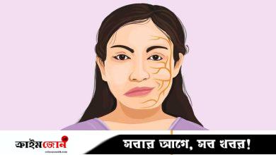 মুখ বেঁকে যাওয়া রোগের চিকিৎসা