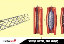 হার্টের রিংয়ের দাম কমল ৩ থেকে ৮৮ হাজার টাকা