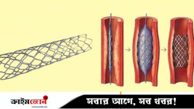 হার্টের রিংয়ের দাম কমল ৩ থেকে ৮৮ হাজার টাকা