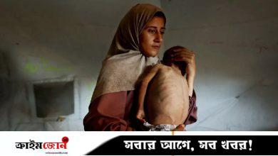 গাজায় আরও ৭৪ জনের প্রাণহানি, দৈনিক গড়ে ২৮ শিশুর মৃত্যু