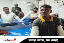 মানিক মিয়া অ্যাভিনিউয়ে বেলুন বিস্ফোরণে দগ্ধ ১১ জন বার্ন ইনস্টিটিউটে