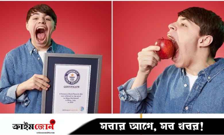 সবচেয়ে বড় হা করে বিশ্ব রেকর্ড মার্কিন তরুণের