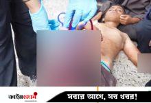 গাজায় তীব্র রক্তসংকট, বাড়ছে ইসরায়েলি হামলা ও অনাহারে মৃত্যুর সংখ্যা