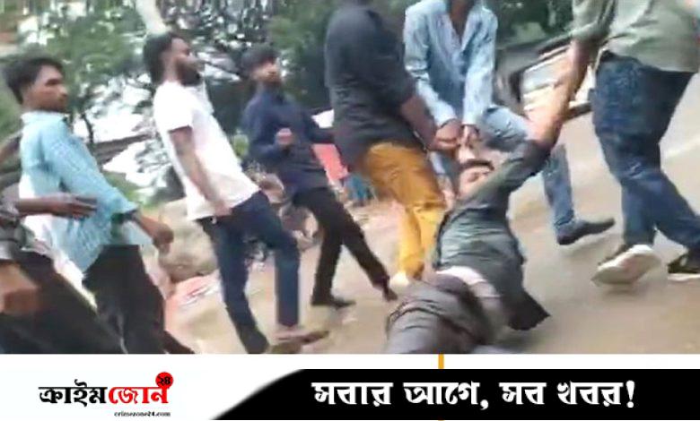 গাজীপুরে ইট দিয়ে সাংবাদিকের পা থেঁতলে দিয়েছে দুর্বৃত্তরা