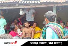 হাসপাতালে অ্যান্টিভেনম নেই, সাপের কামড়ে দুই সপ্তাহে ৫ মৃত্যু