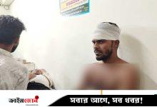 শিবচরে বিএনপি নেতা-কর্মীদের ওপর হামলা, আহত ২৫