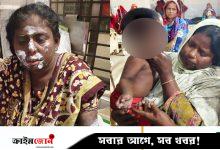 কেশবপুরে সিগারেট থেকে ভবনে অগ্নিকাণ্ড, এক পরিবারসহ দগ্ধ ৭
