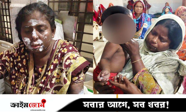 কেশবপুরে সিগারেট থেকে ভবনে অগ্নিকাণ্ড, এক পরিবারসহ দগ্ধ ৭
